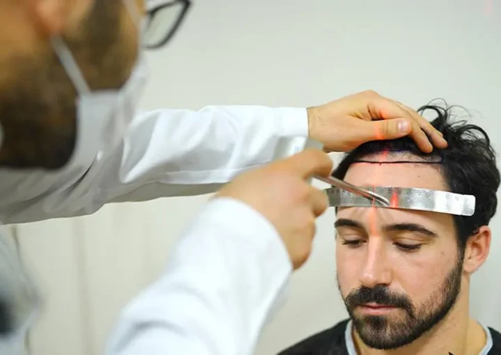 dhi hairline design laser marking turkey