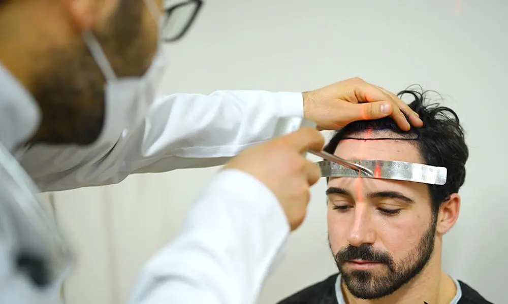 dhi hairline design laser marking turkey