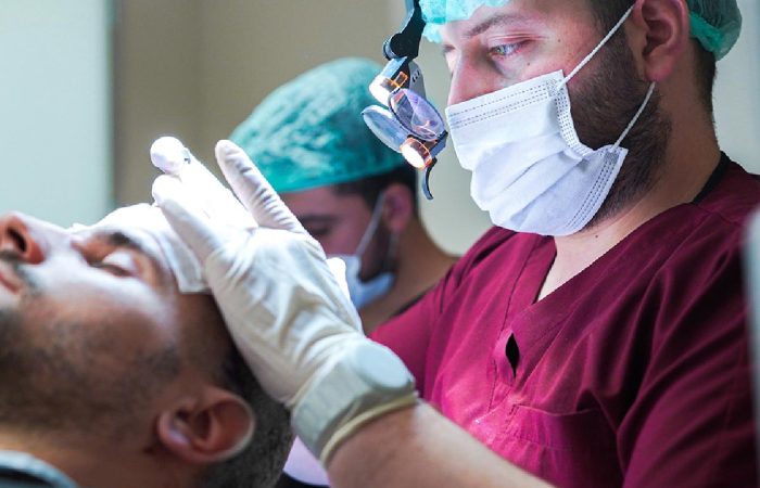 Long Hair Fue 43 fur hair transplant hermest