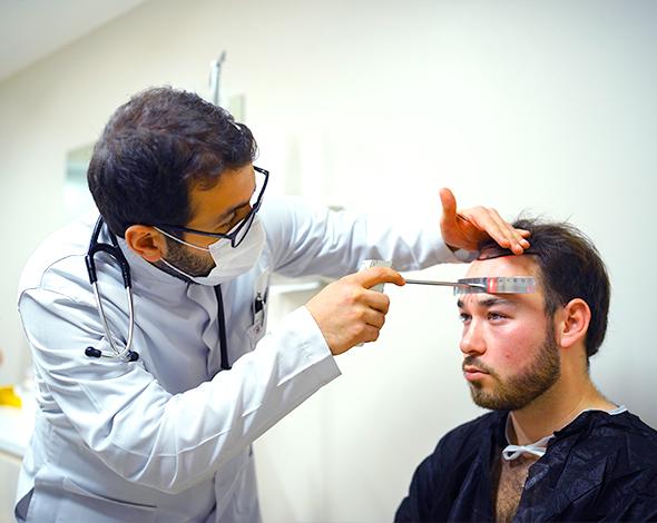 hairline design before fue transplant turkey
