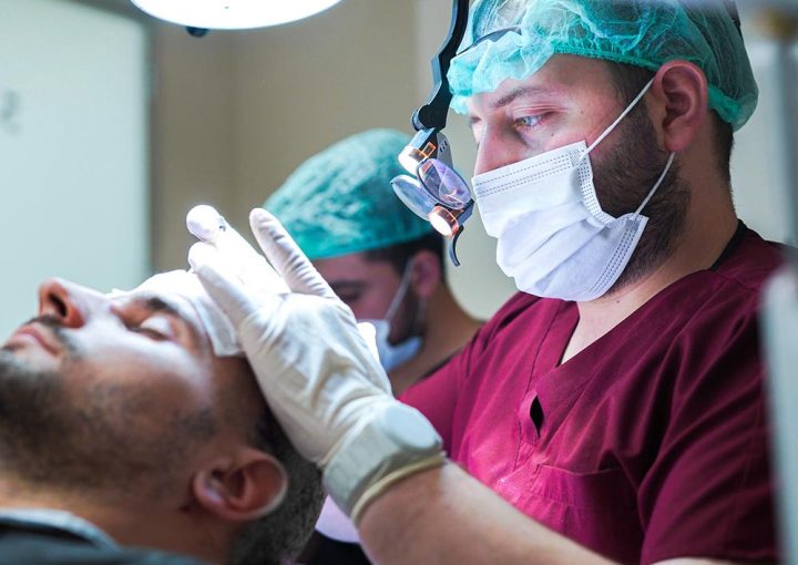 Long Hair Fue 61 hairline design fue turkey surgeon