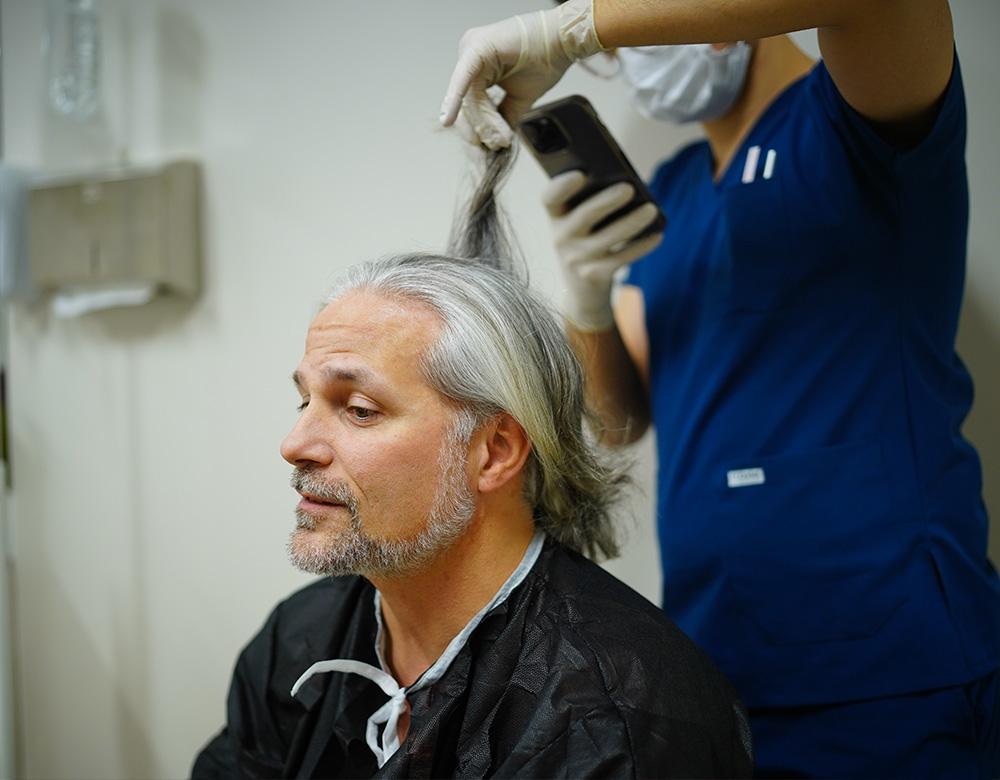 long hair fue gray hair transplant result