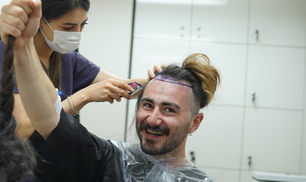 top long hair fue transplant hermest