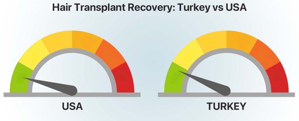 Hair Transplant Turkey vs USA: Prices, Results & Risks 4 Hair Transplant Recovery: Turkey vs USA