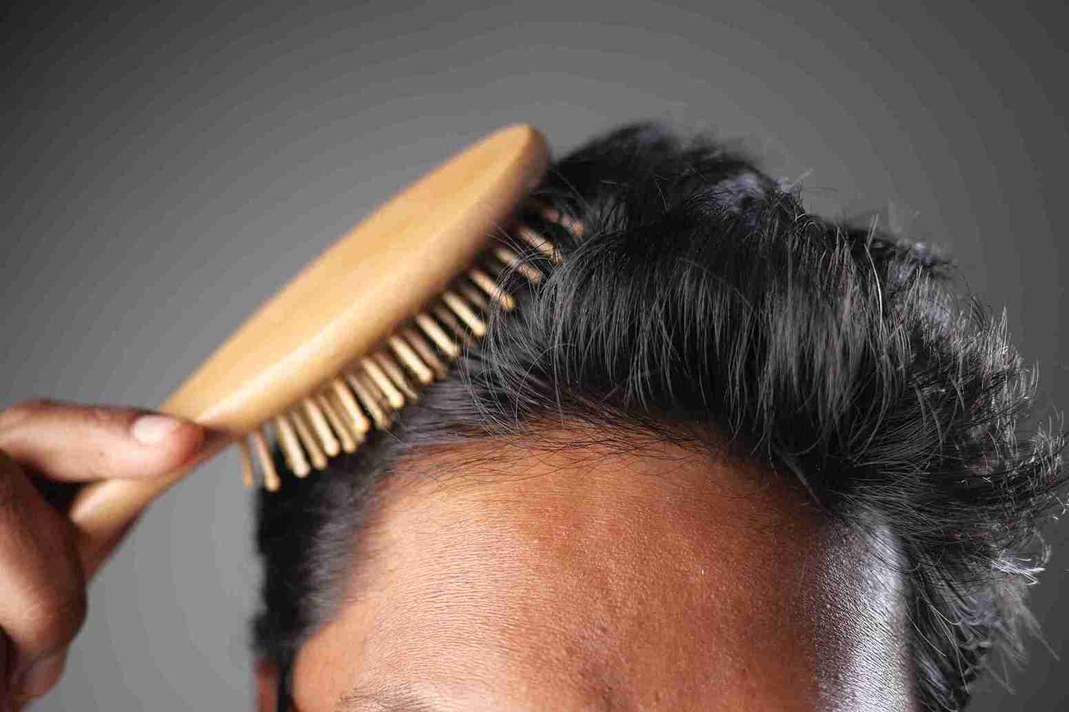 Haartransplantation ohne Eigenhaar