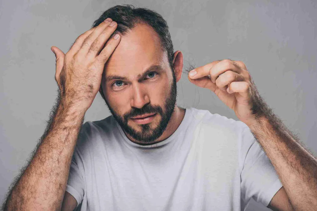 Mann mit Haarausfall