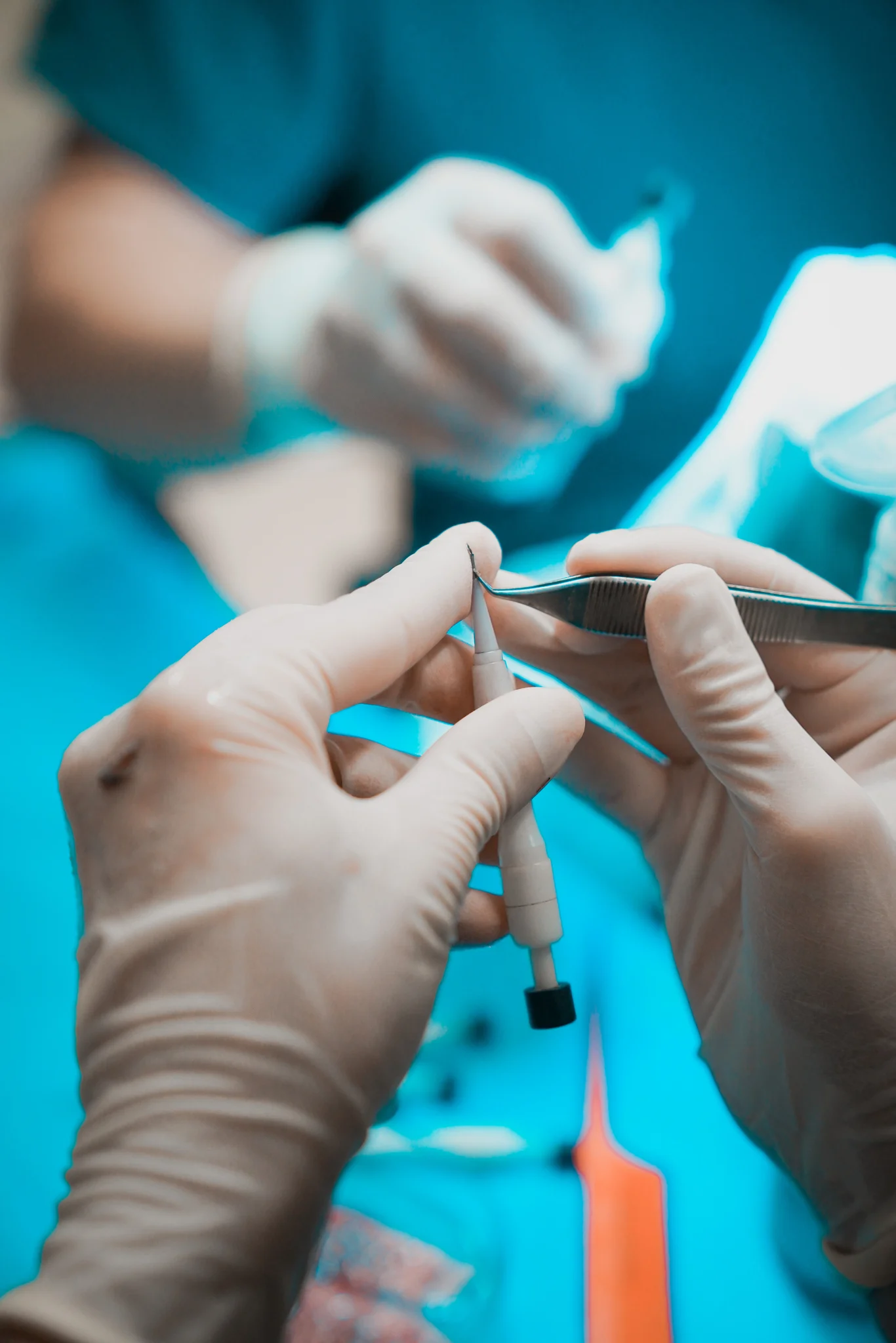 DHI: direct implantation approach