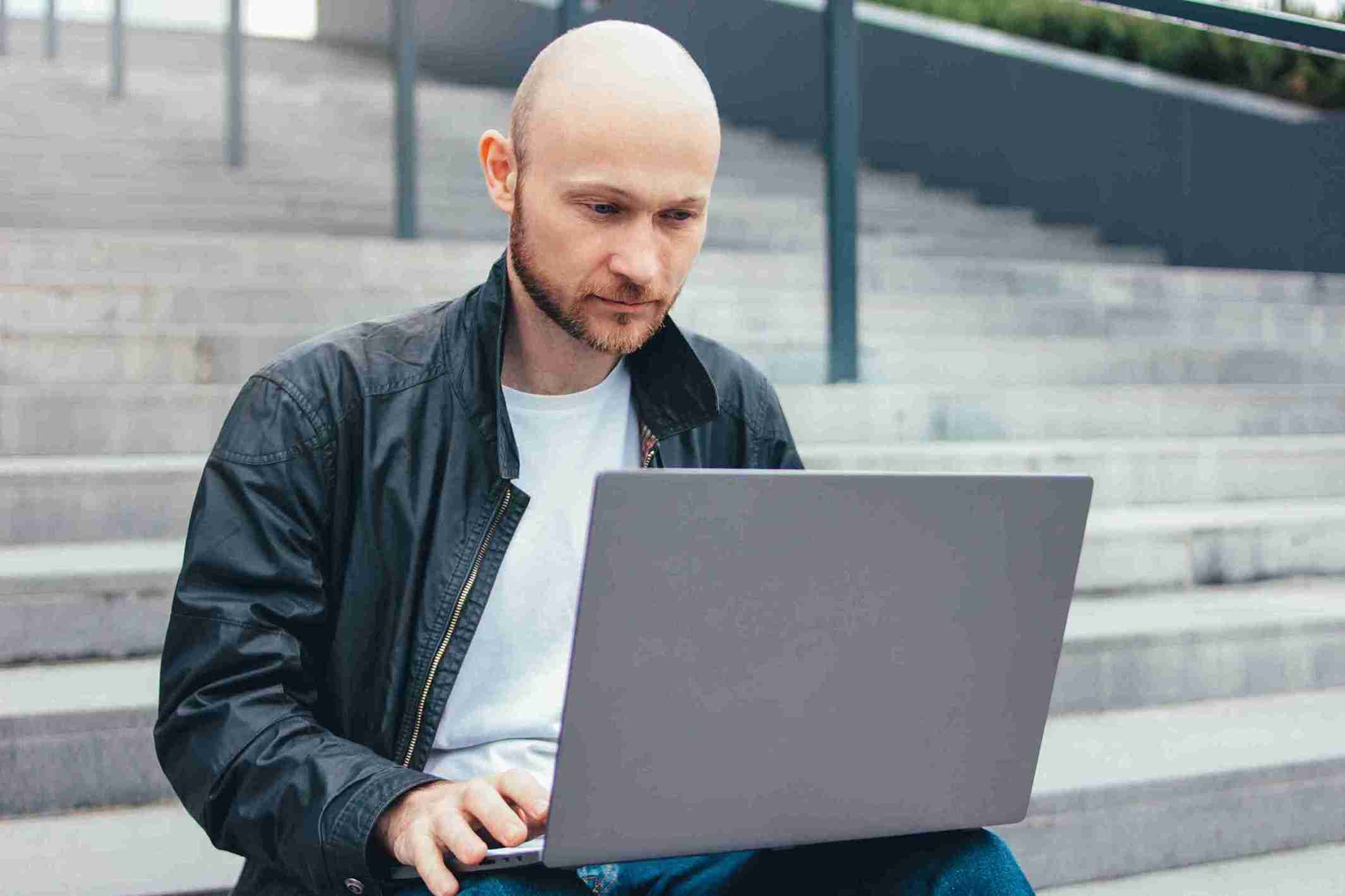 Mann stöbert durch Haartransplantation Foren am Laptop.