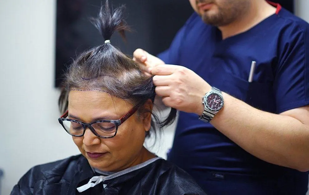 Sac Ekildikten Sonra Ekim Yapildiği Anlasilir mi