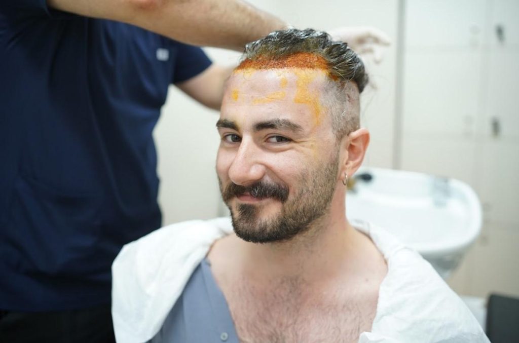 Saç Ekim Operasyonu Hangi Ortamda Yapılmalıdır