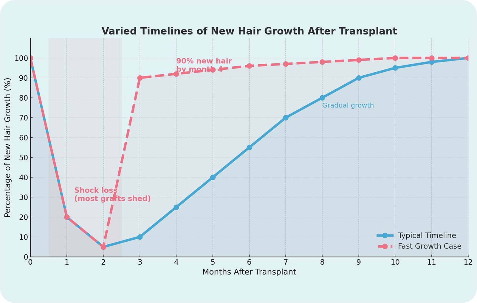 Chart comparing typical and fast hair growth after transplant. In the typical case, hair regrows gradually over 12 months. In the fast-growth case, 90% of hair appears by month 4. Both show initial shock loss in the first two months.