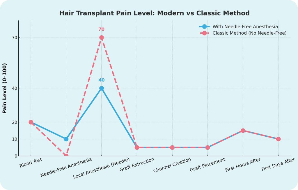 Is a Hair Transplant Surgery Painful? 4 A comparison chart showing the significantly lower pain level of needle-free anesthesia versus traditional methods during a hair transplant in Turkey