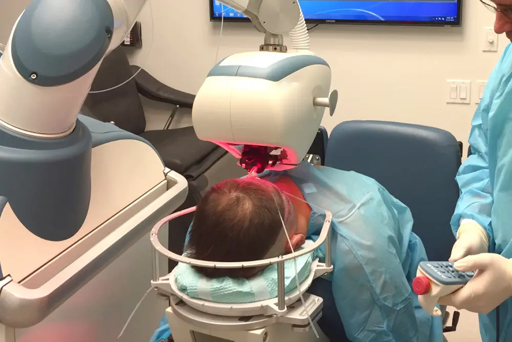 Robotic Hair Transplant in Turkey: Is the Hype Real or Just Marketing 3 robotic hair transplant