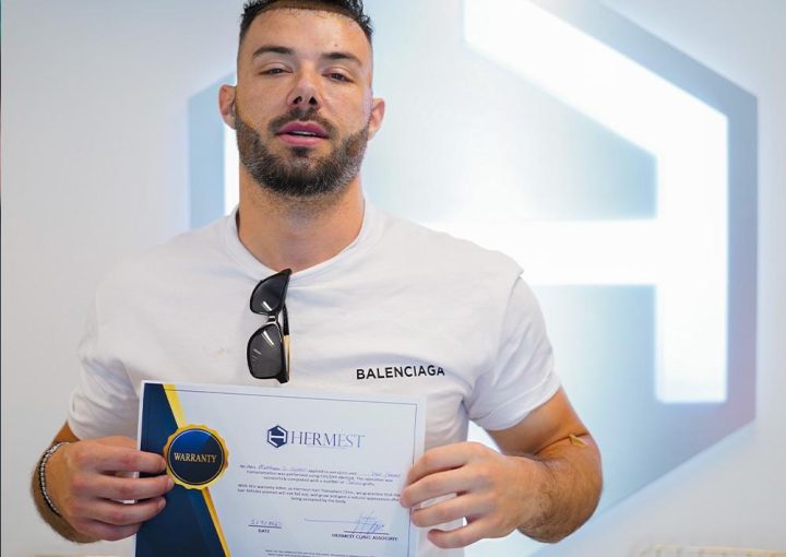 Barttransplantation Türkei – voller Bart & Selbstbewusstsein 7 Ein zufriedener Patient nach der Barttransplantation