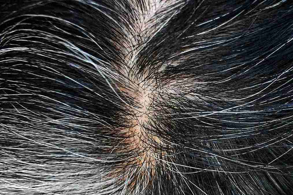 Nahaufnahme einer Kopfhaut. Artikelbild zum Thema Haarwurzeln aktivieren.