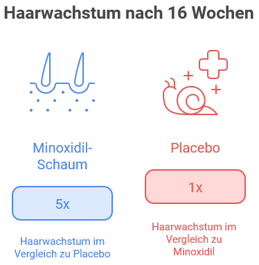 Minoxidil gegen Haarausfall – alles, was Sie wissen müssen 2 Infografik mit der Überschrift „Haarwachstum nach 16 Wochen“. Links ein Symbol mit Haarwurzeln für „Minoxidil-Schaum“ in Blau, darunter der Hinweis „5x Haarwachstum im Vergleich zu Placebo“. Rechts ein Symbol mit einer Schnecke und Kreuz für „Placebo“ in Rot, darunter „1x Haarwachstum im Vergleich zu Minoxidil“.
