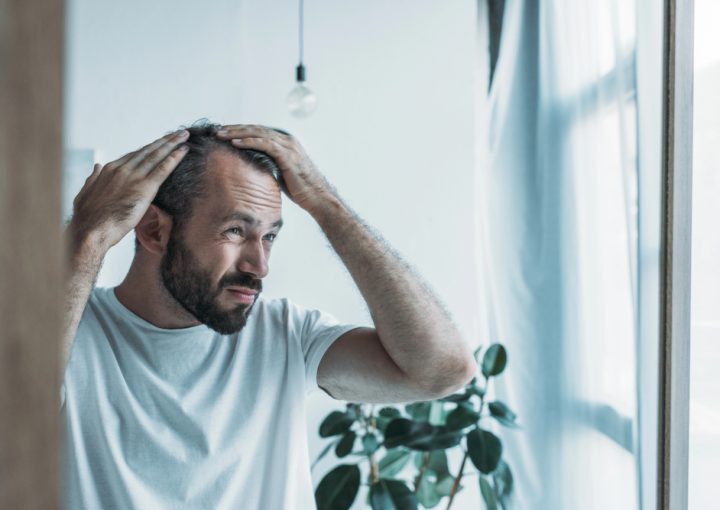 Does Smoking Cause Hair Loss? Effects, Studies & Treatments 1 can smoking cause hair loss
