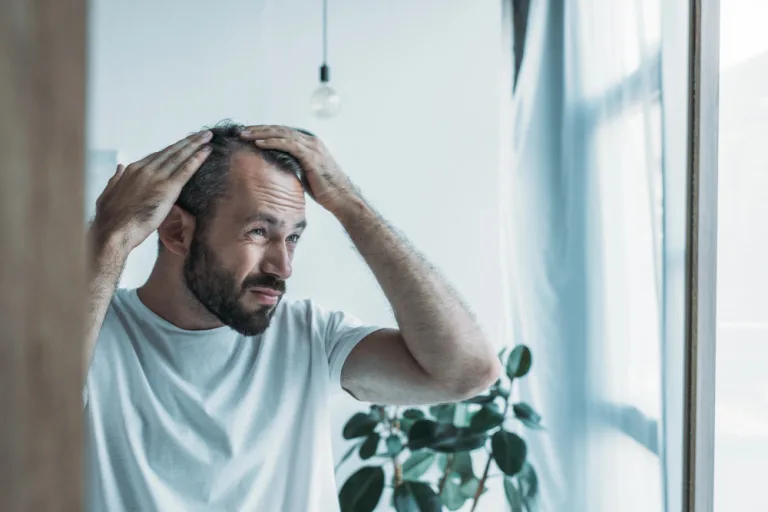 can smoking cause hair loss