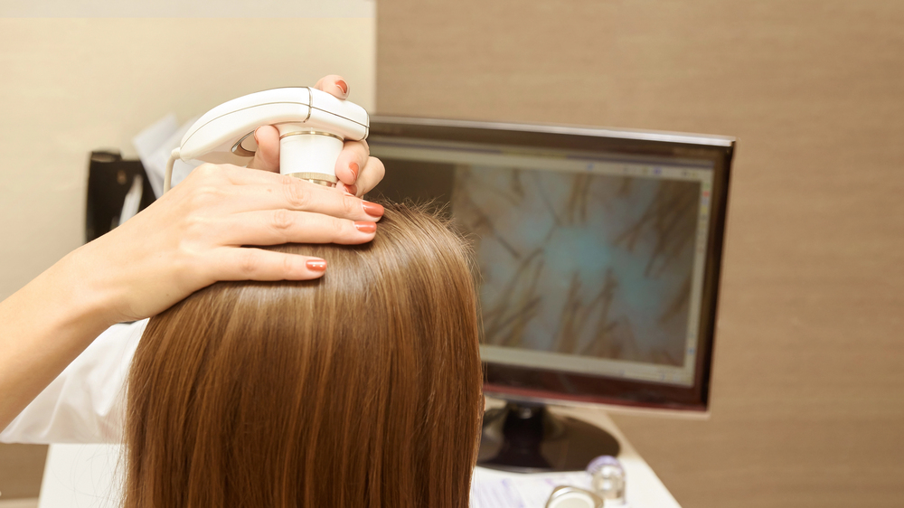 hair loss diagnostics