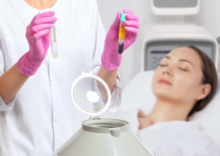 PRP Treatment: Benefits, Procedure, Cost & Effectiveness 2 prp theraphy