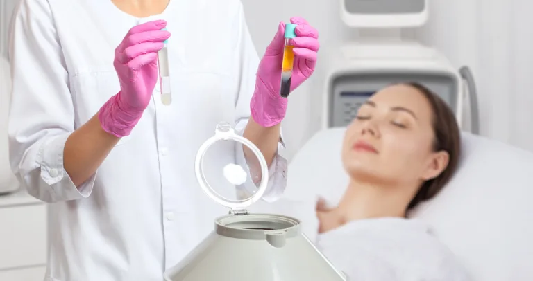 prp theraphy