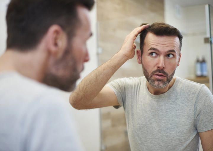 Receding Hairline Best Treatment Options | Men & Women 1 receding hairline best treatment options