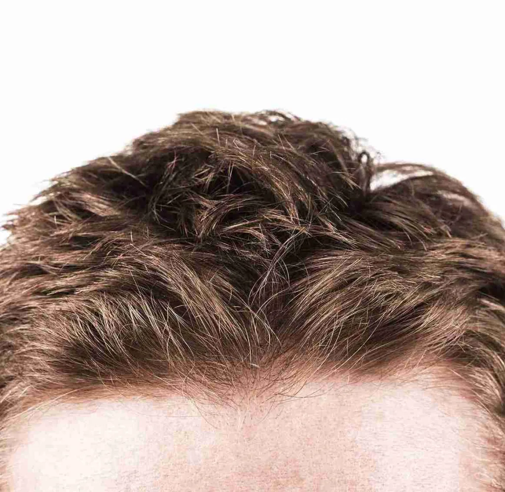 Nahaufnahme von dichtem, gesundem braunem Haar auf einer Stirn – Symbol für gepflegtes Aussehen und Methoden, um Haarwachstum fördern zu können.