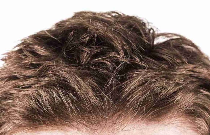 Haarwachstum fördern: Was hilft wirklich dem Haarwachstum? 13 Nahaufnahme von dichtem, gesundem braunem Haar auf einer Stirn – Symbol für gepflegtes Aussehen und Methoden, um Haarwachstum fördern zu können.