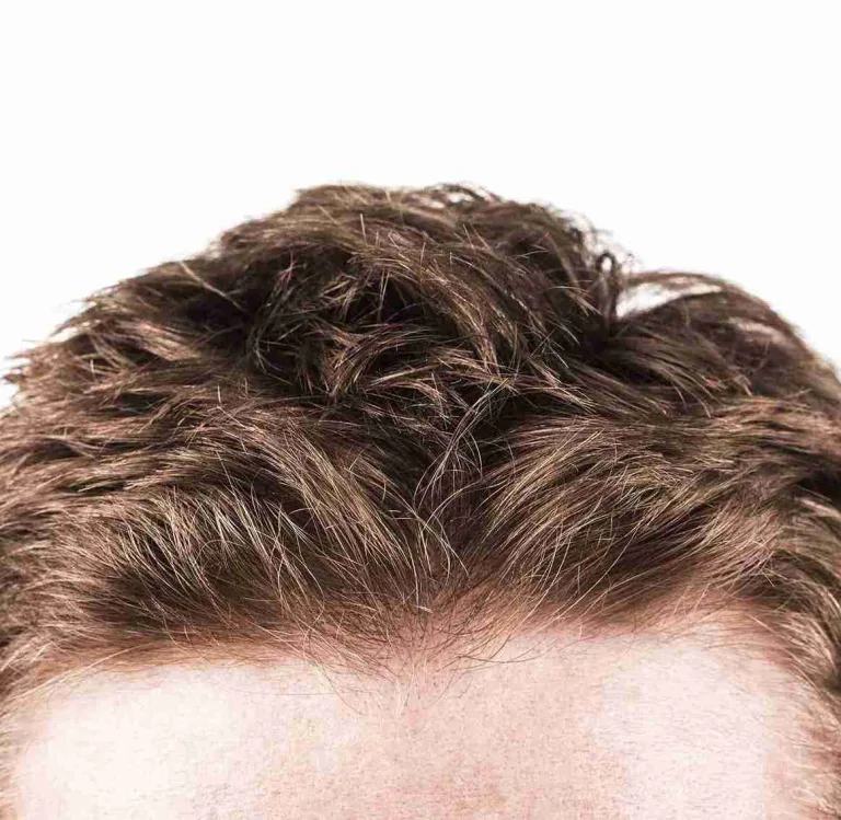 Nahaufnahme von dichtem, gesundem braunem Haar auf einer Stirn – Symbol für gepflegtes Aussehen und Methoden, um Haarwachstum fördern zu können.