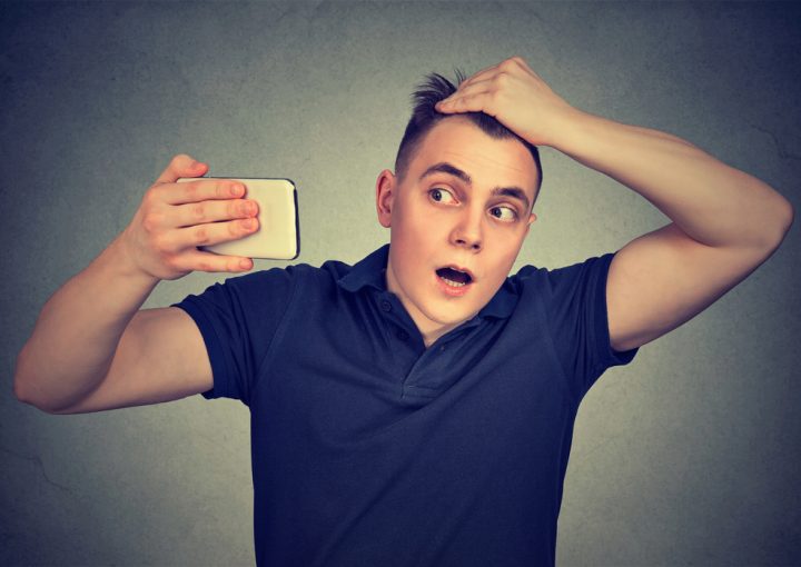 Teenage Hair Loss: Causes, Treatments & Prevention Tips 9 teenage hair loss