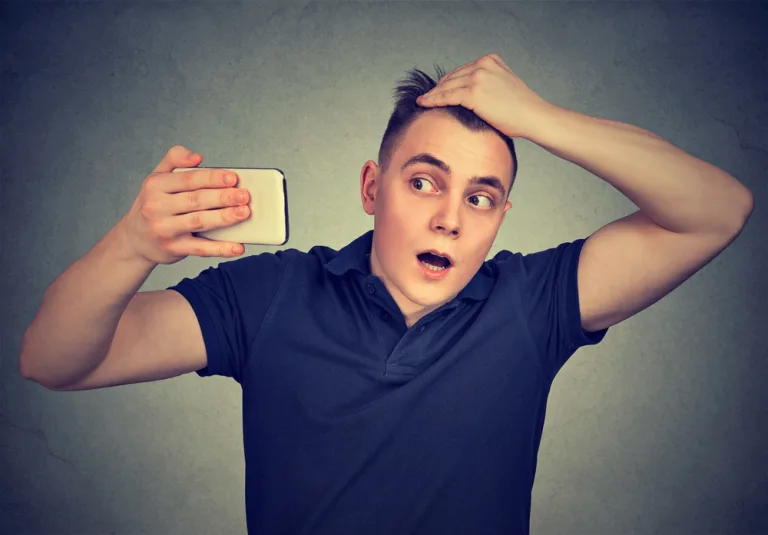 teenage hair loss