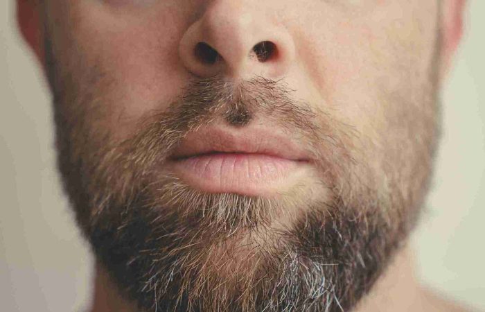 Lücken im Bart – Was Sie für einen vollen Bart tun können! 9 Nahaufnahme eines männlichen Gesichts mit Vollbart, der ungleichmäßig wächst. Es sind deutlich Lücken im Bart zu erkennen, insbesondere im Bereich über der Oberlippe und am Kinn