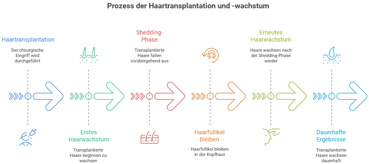 Infografik mit dem Titel „Prozess der Haartransplantation und -wachstum“. Der Ablauf ist in sechs Phasen dargestellt, jeweils mit Symbolen und Pfeilen verbunden