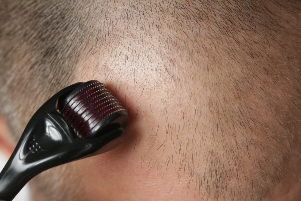derma roller for hair gorwoth men