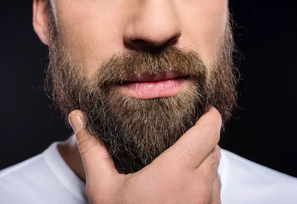 Beard transplant