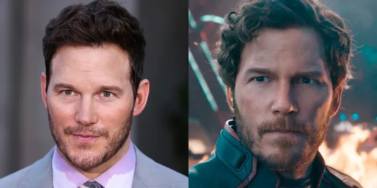 Chris Pratt Hair Transplant: Facts, Hairline Analysis & Truth 4 Chris Pratt Hair Transplant Review