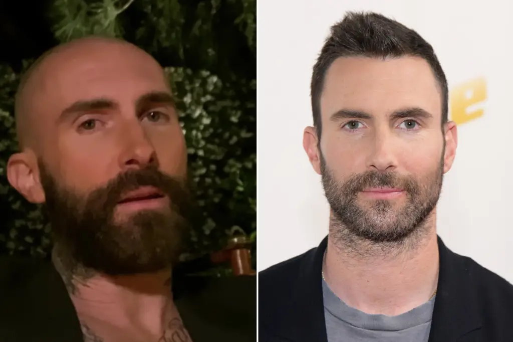 Did Adam Levine get a hair transplant?
