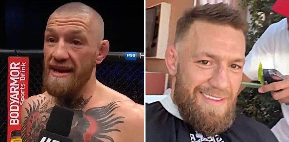 Conor McGregor Hair Transplant: Before & After, Truth & Results 2 What happened to Conor McGregor’s hair