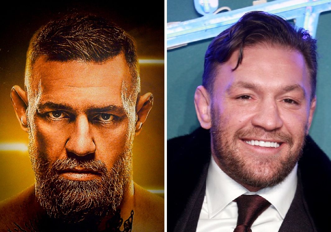 Conor McGregor Hair Transplant: Before & After, Truth & Results 5 If he had a transplant, what technique was likely used?