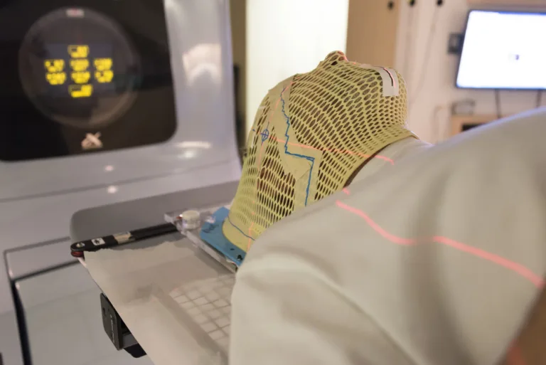 does radiotherapy cause hair loss