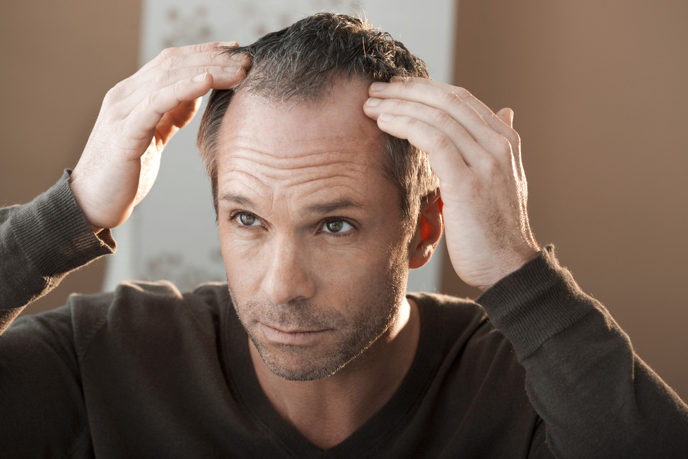 Does Radiotherapy Cause Hair Loss? Hair Loss from Radiation Explained 3 Where does hair loss happen during radiotherapy?
