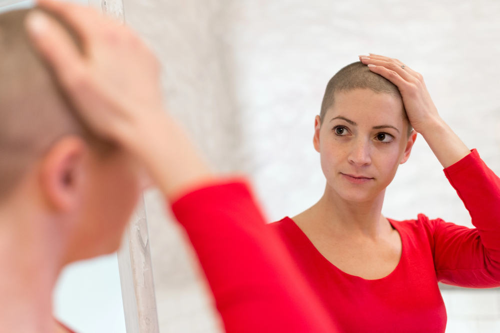 Does Radiotherapy Cause Hair Loss? Hair Loss from Radiation Explained 4 radiotherapy hair loss women