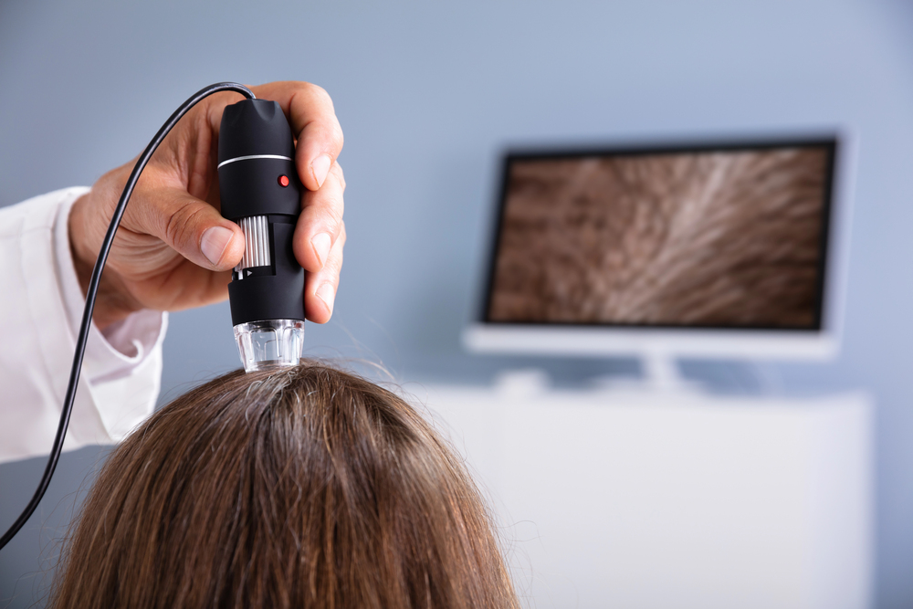 Scalp Health: How to Combat Pimples and Maintain Clear Skin 4 scalp care