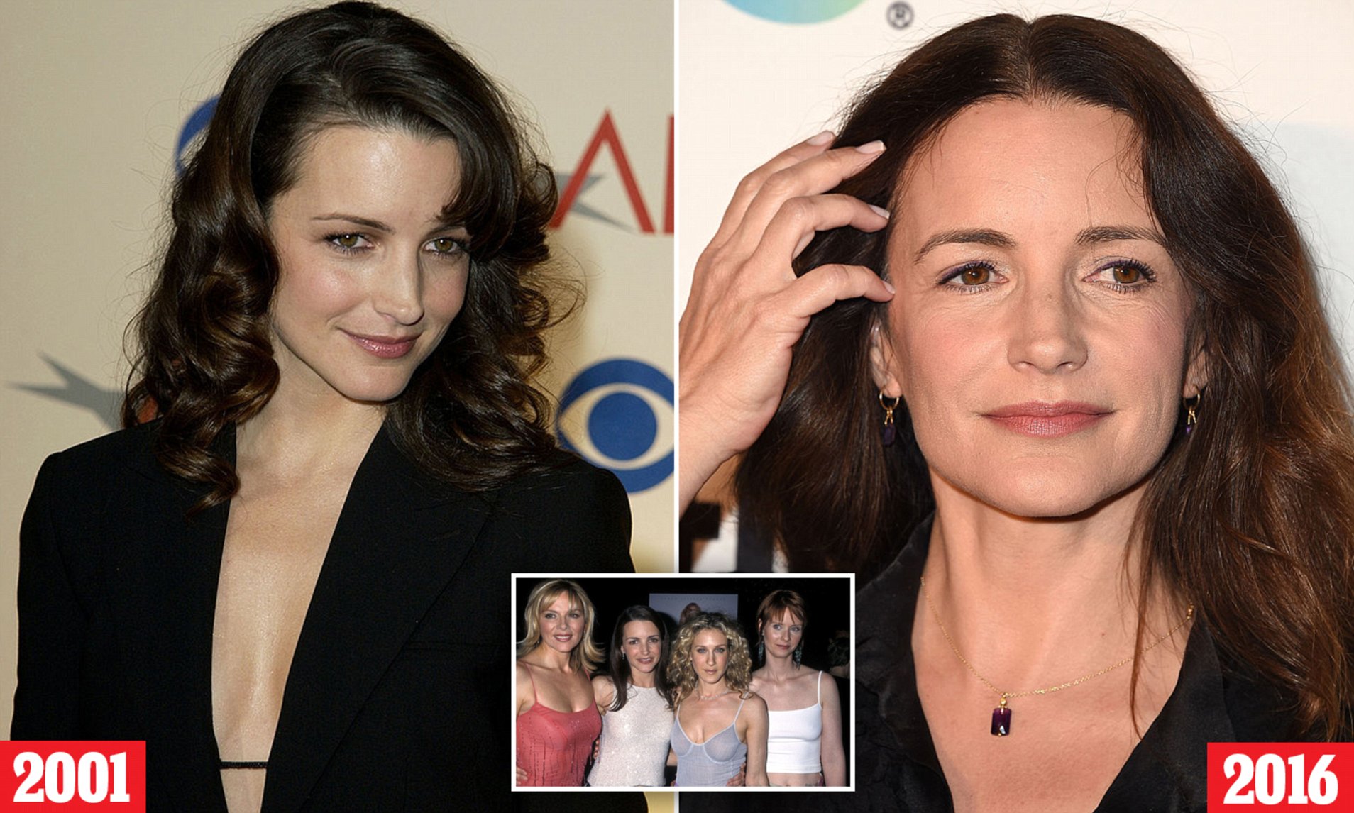 Top Celebrities with Alopecia: Real Cases, Types & Treatment 16 Kristen Davis