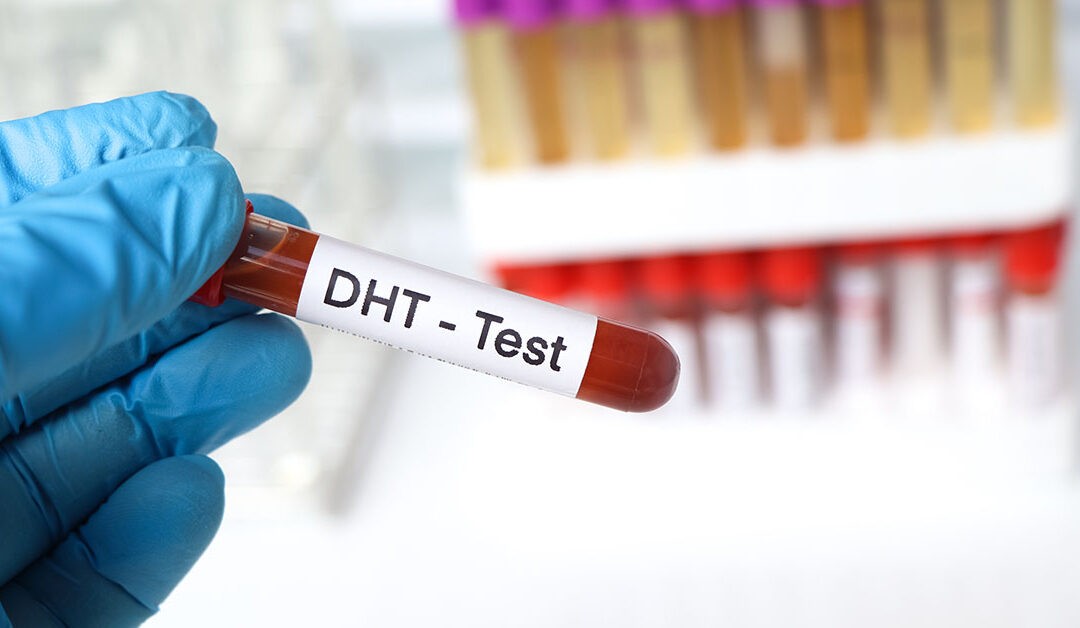 Relationship Between Creatine and Hair Loss: DHT, Shedding & Recovery 3 What DHT does to hair follicles