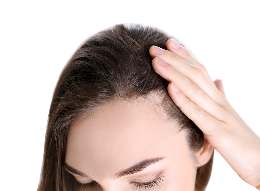 Choosing the Right Hairline: Types, Face Shapes & Transplant Guide 9 What defines a female hairline