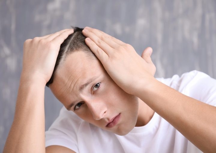 hair loss teenage guys review