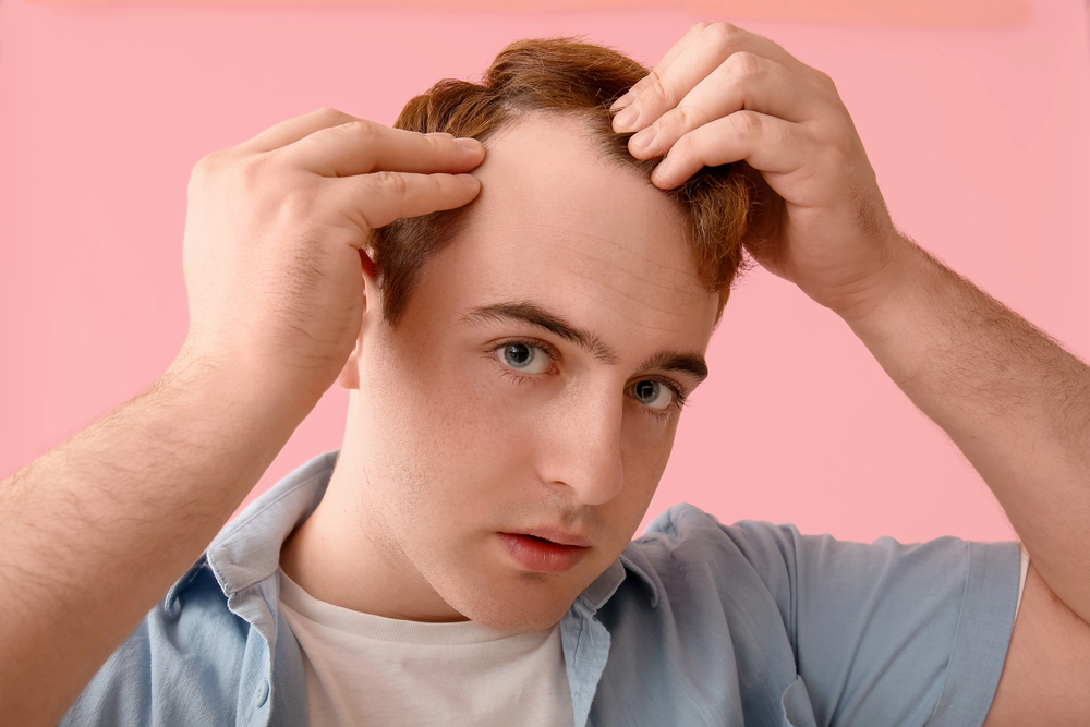 How to Stop Hair Loss in Teenage Guys: Causes, Reversal & Treatment 5 How to stop hair loss in teenage guys