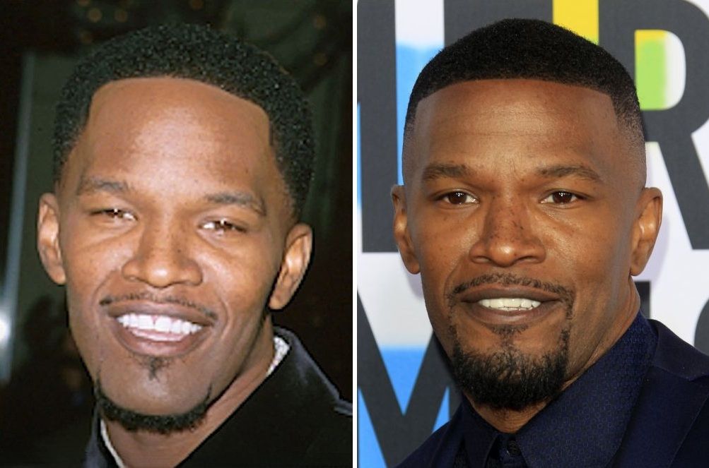 Jamie Foxx Hair Transplant: Hairline Analysis & Results Explained 2 jamie foxx hair transplant