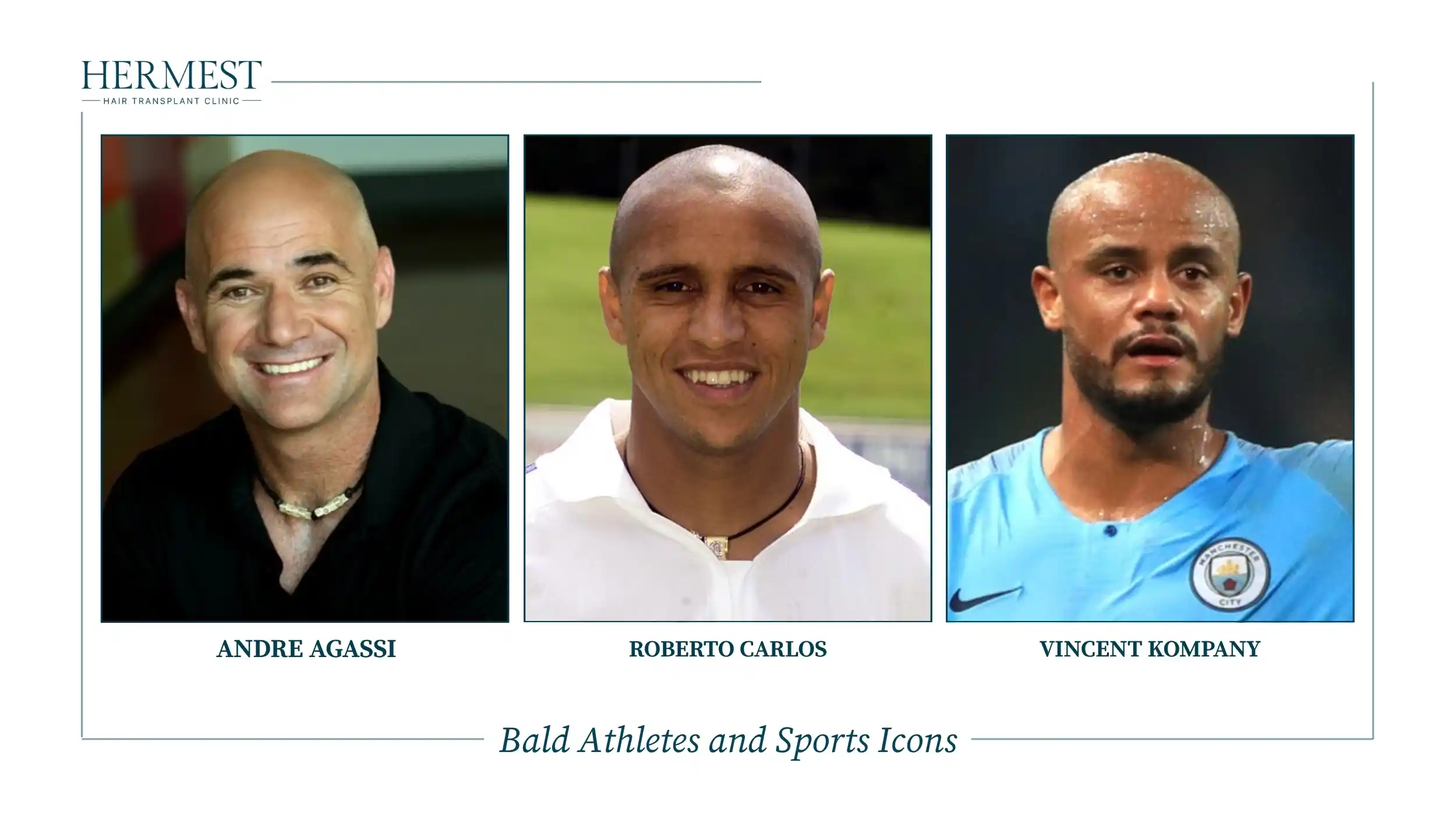 Bald athletes Andre Agassi, Roberto Carlos and Vincent Kompany
